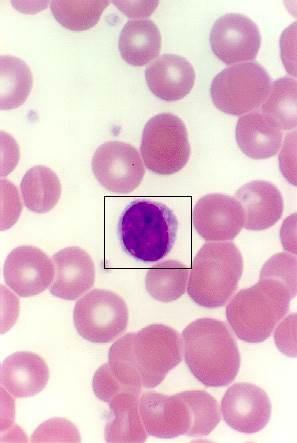 Lymfocyty 20-25 % v DBOK cytoplazma modrá s azurofilními granuly, četné ribosomy jádro kulaté,