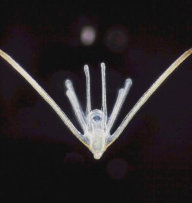 tělní soustavy Ophiuroida Ophiuroida hadice rozmnožování většinou gonochoristé, gonády přestavují malé váčky připevněné k burzálním