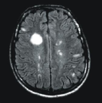 Diagnostika revidovaná dg.