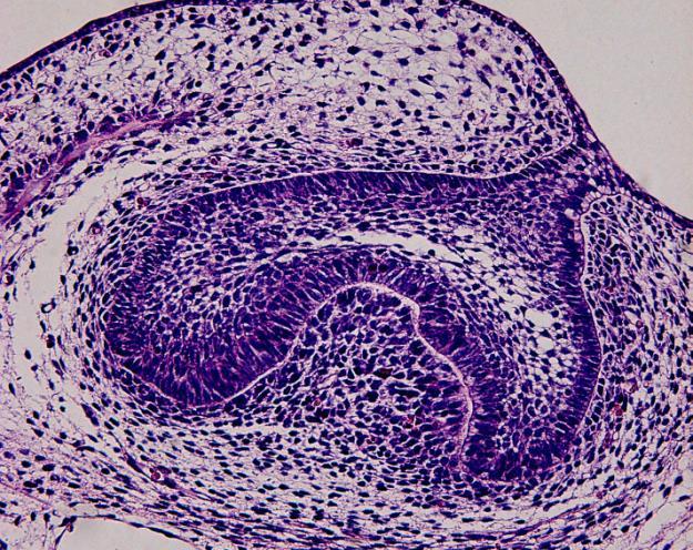 apoptotické procesy během odontogeneze Proč savci (včetně člověka) mohou iniciovat