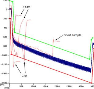 tight tip seal and reduced aerosol formation Prevention of droplet formation with pressure monitoring