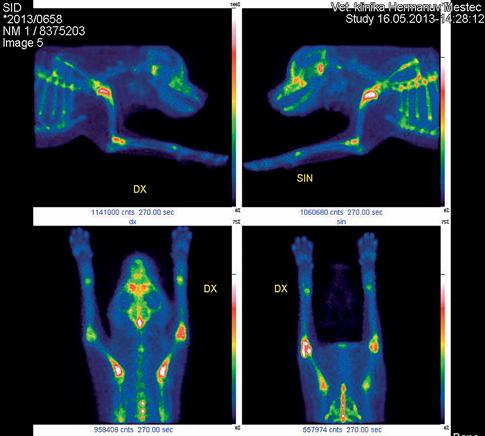 CT vykazuje výrazně vyšší senzitivitu při detekci MCD než rentgenologické vyšetření.