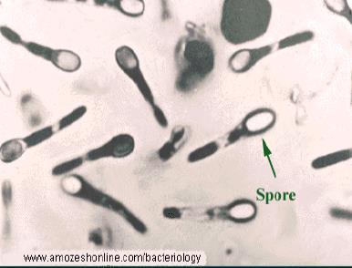 Bacillus difficilis = Clostridium difficile Gram pozitivní, spory tvořící anaerobní bakterie historie Hall a O Toole r.