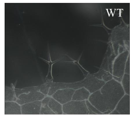 8.2.3 Projev zkroucených trichomů Studium role větvení a růstu trichomů u arp2/3 mutantních rostlin je velmi zajímavé zvláště proto, že odhaluje roli ARP2/3 komplexu v kontrole buněčné polarity.