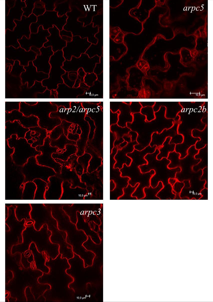 Obrázek 6: Na obrázku jsou pokožkové buňky WT, arpc5, arp2/arpc5, arpc2b a arpc3.