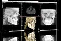 PROGRAM KURZU Kurz pro lékaře, kteří se chtějí seznámit s 3D CBCT nebo kteří již využívají CBCT snímky ke své práci a chtějí získat maximum informací.