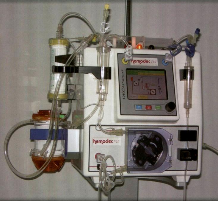 COPD Bridge u LTx Menší potřeba antikoagulace, ale 20x pomalejší průtok krve!