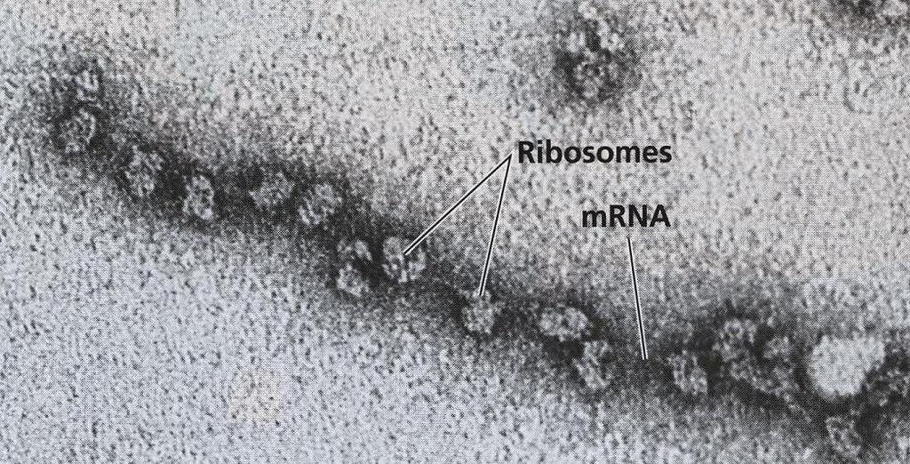 Translace Začátek translace Met-tRNA Rostoucí polypeptidový řetězec Aminoacyl trna 3`UA 5` mrna 5` AUG 3` START kodon Konec translace Volné trna E P A 3` mrna 5` UAG 3` mrna 5` UAA 3`