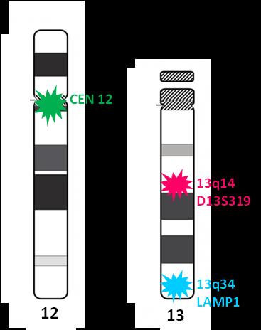 94, 131, 204, 222 a 219) byly provedeny další FISH analýzy deletované oblasti 13q14 se sondou pro lokus DLEU1 (s kontrolou v 13qter, Kreatech, viz výše),