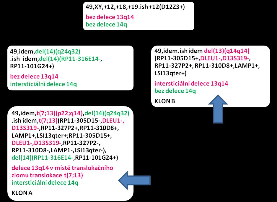 Obrázek 4.4 Schéma klonálního vývoje u pacienta s nezávislou koexistencí klonů s delecí 13q14 v místě translokačního zlomu a s intersticiální delecí 13q14 Schéma klonální evoluce u pac. č.