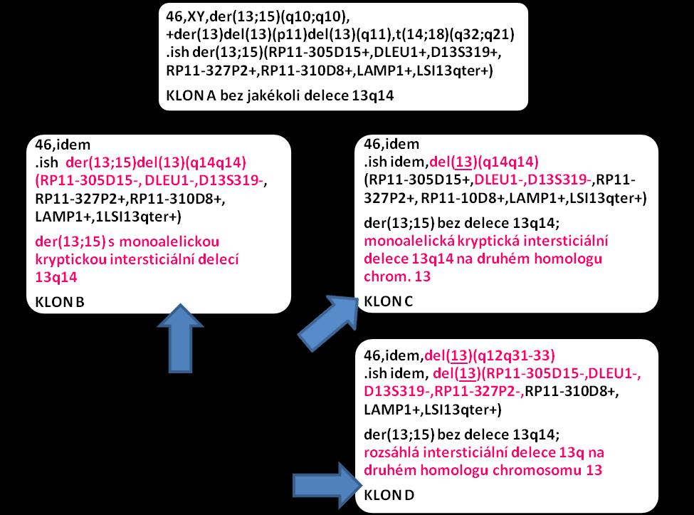 Obrázek 4.7 Schéma klonálního vývoje u pacienta s multiklonální intersticiální delecí 13q14 Schéma klonální evoluce u pac. č.