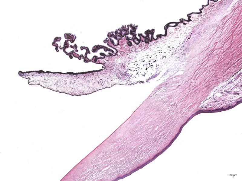 Tunica media oculi choroidea corpus ciliare Cévnatka