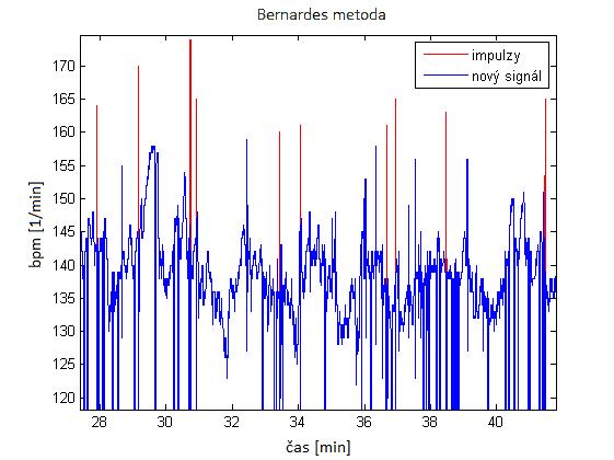 Pokud je tento rozdíl větší než 25 bpm, hodnotu daného vzorku (impulzu) nahradíme nulou. V grafu 1 vidíme červeně vyznačené impulzy, jejichž vzorky jsou následně přepsány nulami.