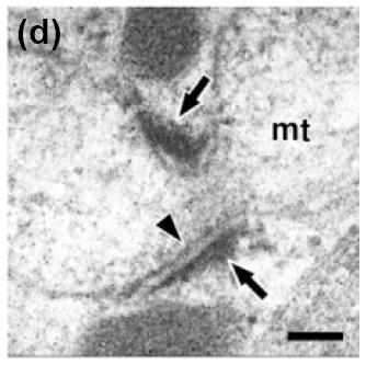 merolae, nebo u Dictyostelium discoideum Geny pro FtsZ přesídlily do eukaryotického jádra.