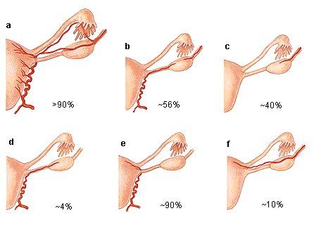 Cevní zásobení dělohy, tuby a ovaria