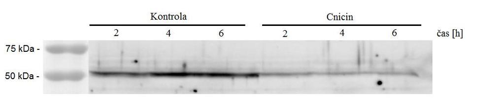 4.2.1. Vliv cnicinu na C-MYC onkoprotein K buňkám byl přidán cnicin o koncentraci 15 µm a byly inkubovány různou dobu od dvou do šesti hodin (obrázek 18).