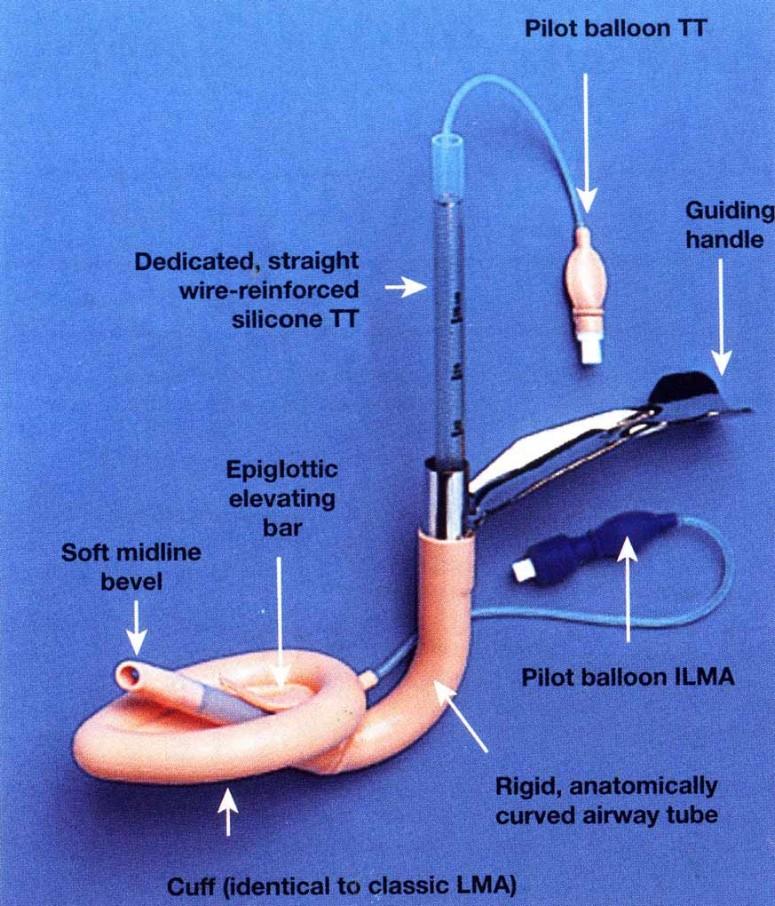 Intubating LMA: LMA Fastrach 1997 Odstranění distorse dýchacích cest, manipulace s