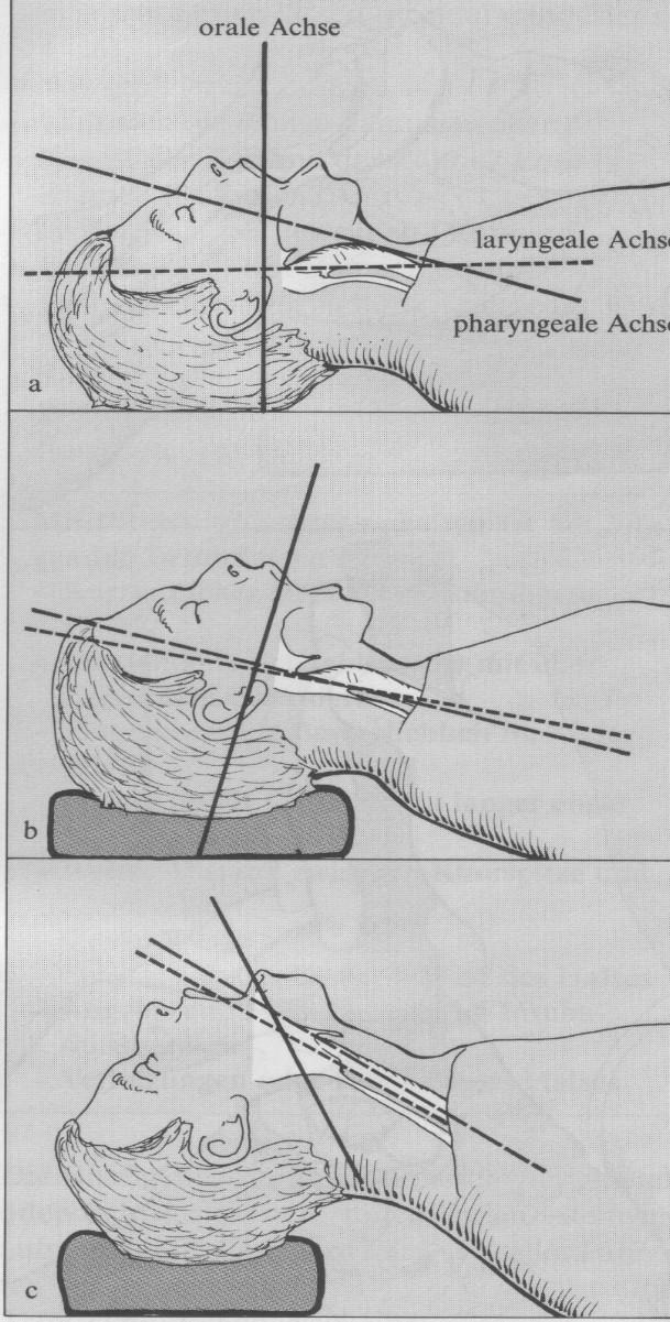 Provedení OTI: připrav pomůcky preoxygenace /ventilace poloha pacienta anestezie /