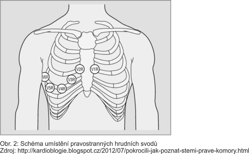 Stanovení diagnózy může být jednoduché prakticky již na základě anamnézy, může však být i velmi náročné s nutností použití mnohých paraklinických metod a konzultace s kolegy jiných odborností.