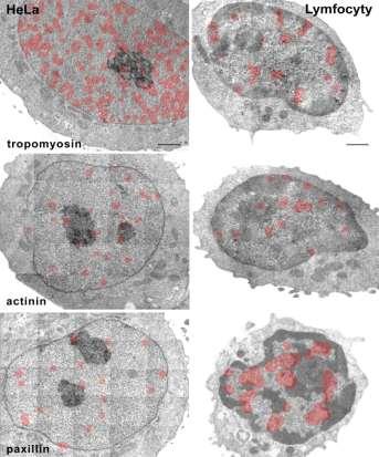 Obrázek 6.: Ultrastrukturální mapovaní tropomyozinu, -aktininu a paxilinu v HeLa buňkách a neaktivních lidských lymfocytech.