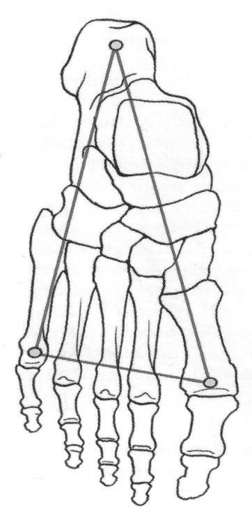 spojením (Naňka, Elišková, 2009, Dungl, 1989). Schéma opory nohy prostřednictvím tří bodů znázorňuje obrázek 5. Obrázek 5. Opora nohy tzv. třínožka (Eliška, Elišková, 2009).