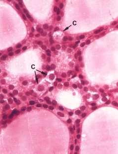 thyroidea ima (2% - z arcus aortae) Vv. thyroideae sup., mediae et inf.