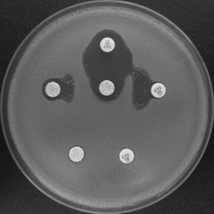 INFORMACE Z NRL A ODBORNÝCH PRACOVIŠŤ SZÚ Tabulka 1: Produkce inducibilní AmpC. Kmen Escherichia coli dobře citlivý ke karbapenemům (MIC MER < 0,125 µg/ml) +OXA 3.4. Ostatní 3.4.1. OXA Jejich fenotypová detekce je velmi obtížná, proto lze spolehlivý průkaz provést pouze molekulárně-genetickými technikami [10].