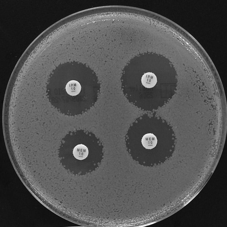 Kmen je producentem inducibilní AmpC: Naznačená zóna D mezi diskem s AMC a ATM. Kmen je producentem MBL: Rozšíření zón mezi inhibitory a diskem s meropenemem a imipenemem.