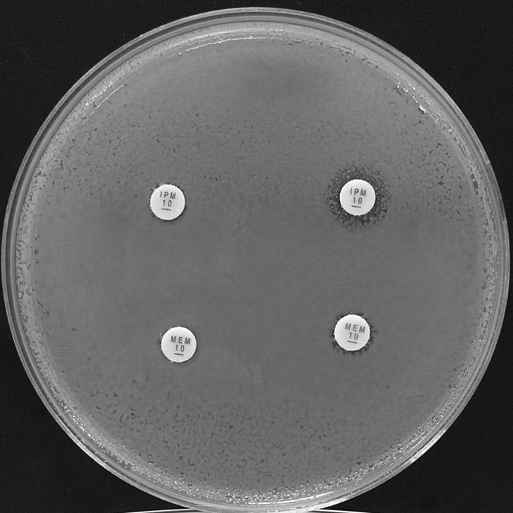 Tabulka 8: Různý stupeň rezistence u producentů karbapenemázy KPC (skupina 2f) u dvou kmenů Klebsiella pneumoniae karbapenemy karbapenemy s k. boritou Oba kmeny vykazují rezistenci ke karbapenemům.