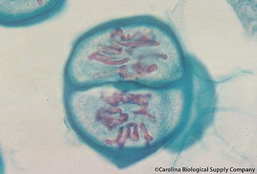 Meióza profáze ii. Mizí jadérka i jaderné membrány. Spiralizace chromozomů - zkrácení a ztlušťování chromatid.