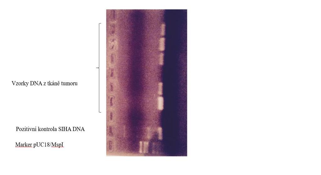 Obrázek 11 Výsledek elektroforézy PCR produktů detekce beta-globinu u vybraných vzorků 3.6.