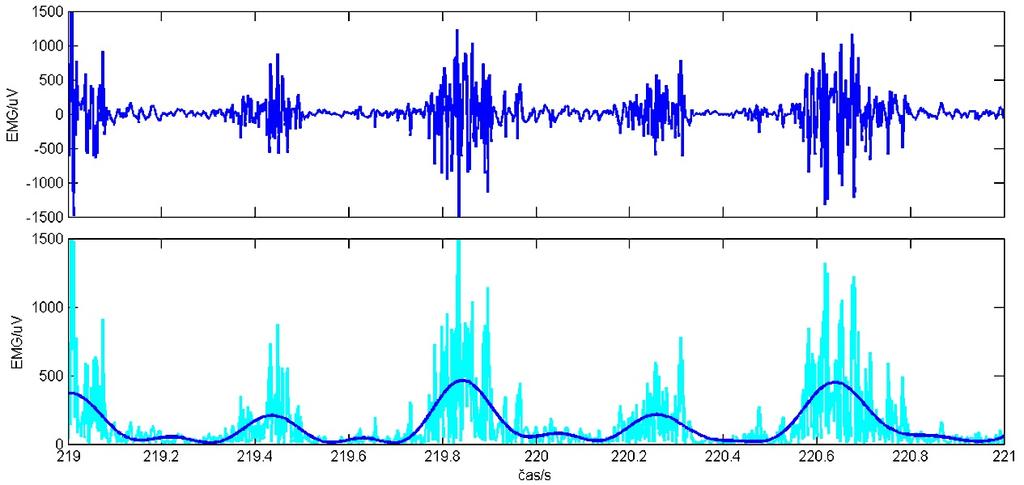 Obr. č. 3-2.: Elektromyografický signál tmavě modrá horní křivka a absolutní hodnota elektromyografického signálu azurová křivka a jeho obálka (tmavě modrá) (archiv autorky).
