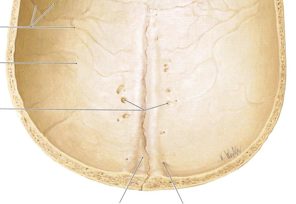 granulares diploe sinus x sinus dutina vyplněná