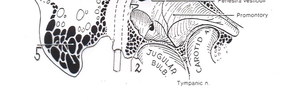 Ventrobasální plocha os petrosummediální stěna cavum tympani antrum mastoideum recessus