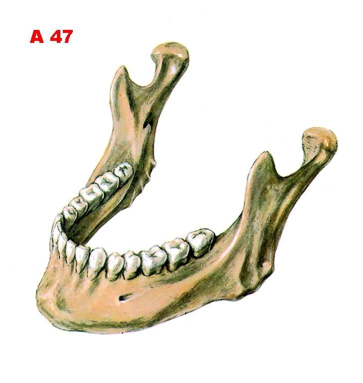 Mandibula anterolaterální pohled foramen mandibulae tuberositas