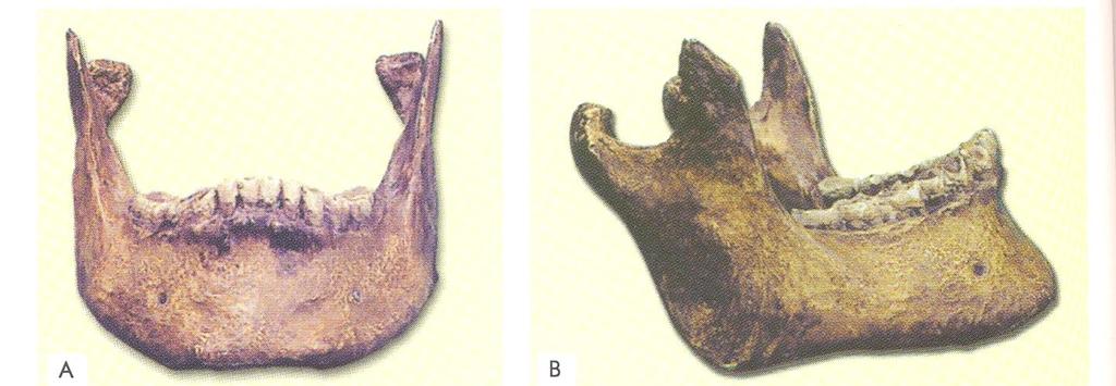 Mandibula