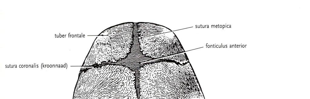Kraniosynostosy tuber frontale sutura coronalis sutura metopica
