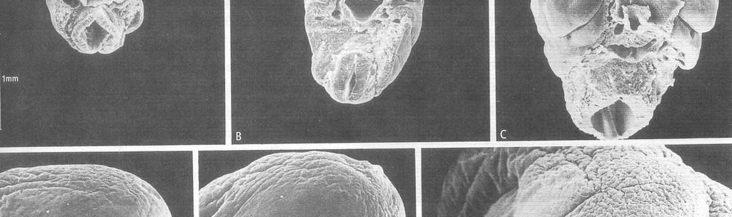 mandibularis 3-processus nasalis