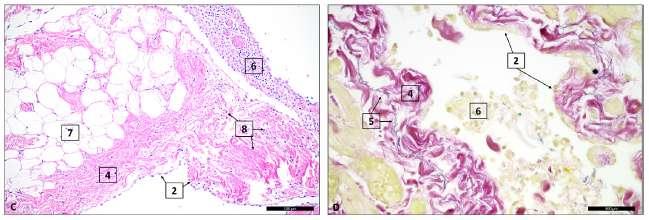 Submesoteliální stroma J.O.A.M van Baal et al. / Tissue and Cell 49 (2017) 95 105 4. Submesoteliální stroma 5. Elastická vrstva 7.