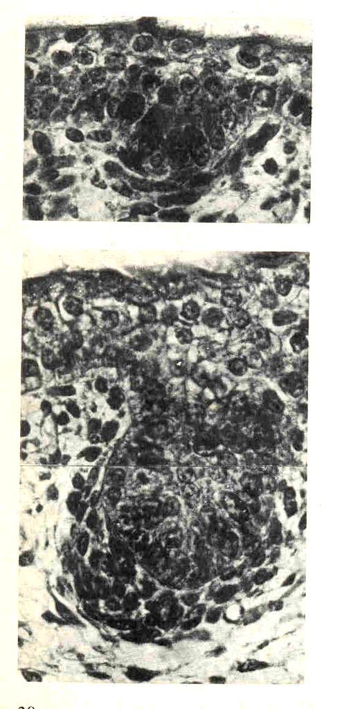 primitivní vlasový zárodek shluk mezodermálních buněk pod stratum basale epidermis (budoucí papila) navozuje mitotickou aktivitu epidermálních buněk, následuje