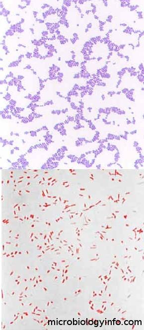 Gramovo barvení G+ bakterie tlustší vrstva peptidoglykanu mureinu pevněji váže krystalová (genciánová) violeť vazbu upevníme Lugolovým