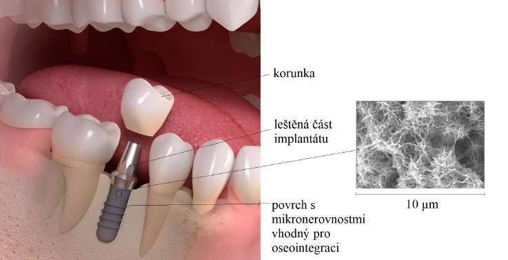 2.3 Oseointegrace 31 Obrázek 2.4: Povrch implantátu s detailem mikrostruktury [43, 44] 2.