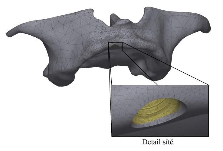 50 3 Výpočtové modelování Obrázek 3.26: Diskretizovaný model geometrie horní čelisti Celkový počet uzlů a prvků jednotlivých variant je uveden v tabulce 3.7. Tabulka 3.
