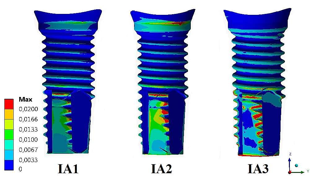 4.2 Analýza napjatosti a deformace implantátu a kostní tkáně 69 přetvoření 0,025 dochází k jejímu