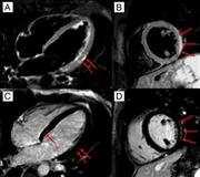 J Am Coll Cardiol. 2012;59(9):779-792. doi:10.1016/j.jacc.2011.09.