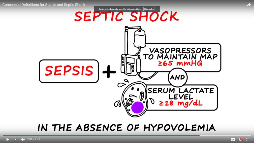 Septický šok klinická kritéria Sepse + hypotenze vyžadující