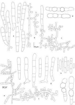 mikrokonidie kolíčkovité, hruškovité 3-5,5 x 2-3,5 µm chlamydospory