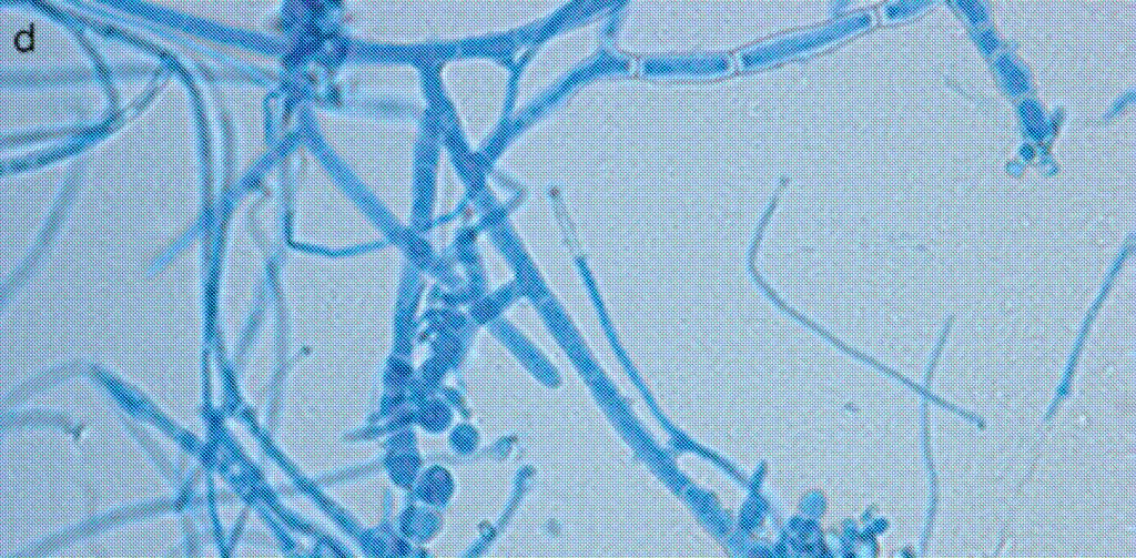 species of Arthroderma benhamiae- A