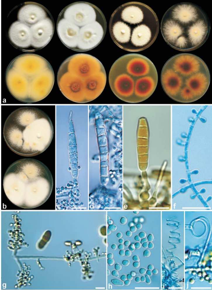 Trichophyton interdigitale Obr. 2. Morfologie Trichophyton interdigitale v současnem pojetí Kolonie různých kmenů T.