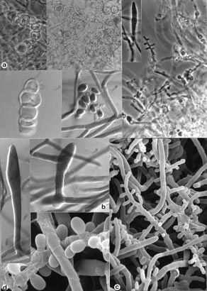 Trichophyton verrucosum sporulace chybí nebo je redukovaná makrokonidie, hladké, tenkostěnné, 4-7 buněčné